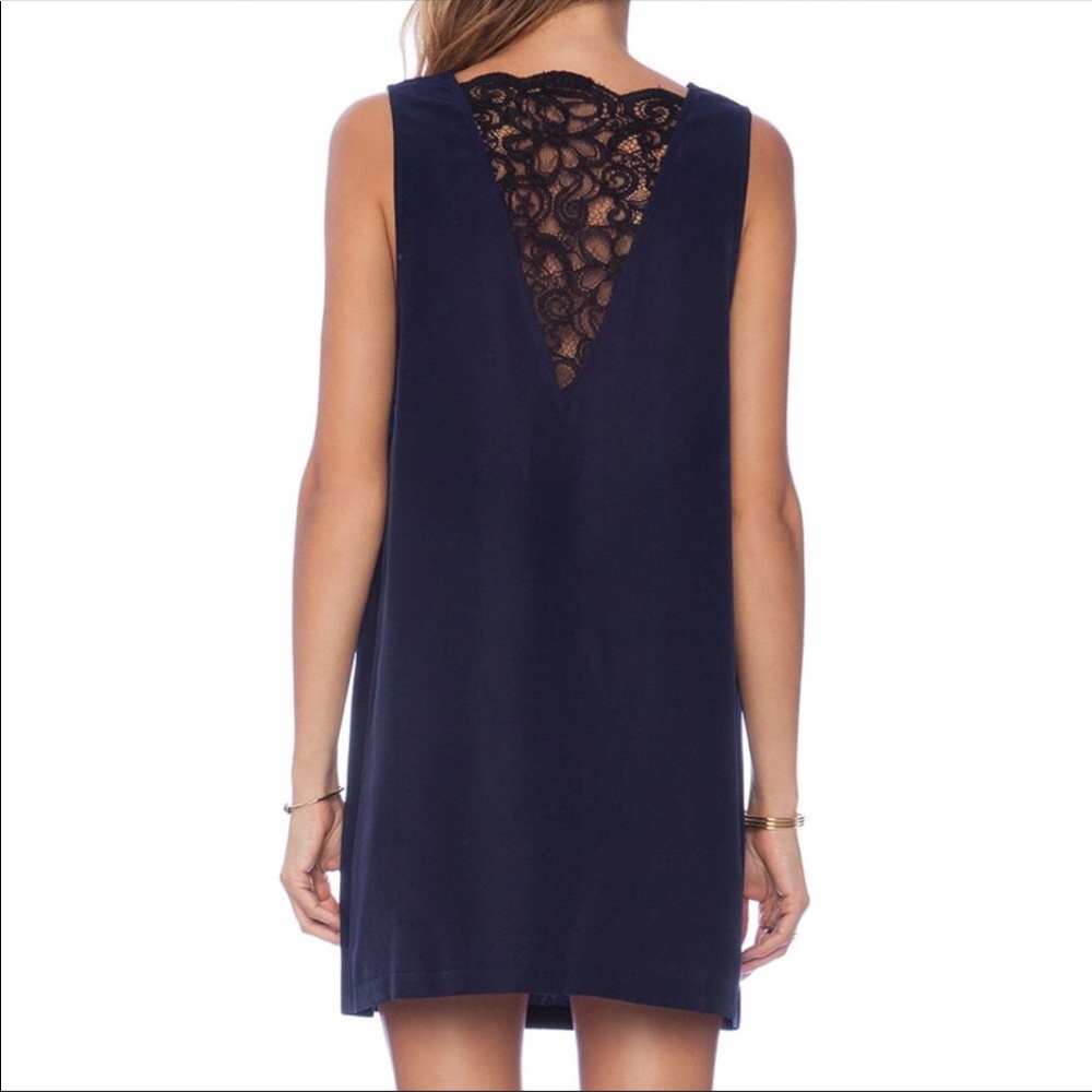 BB Dakota Shift Dress w/ Lace